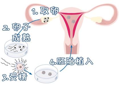 生殖内分泌专家